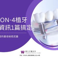 「All-on-4植牙」恢復自信笑容的最佳秘密武器，完整資訊一篇搞定！