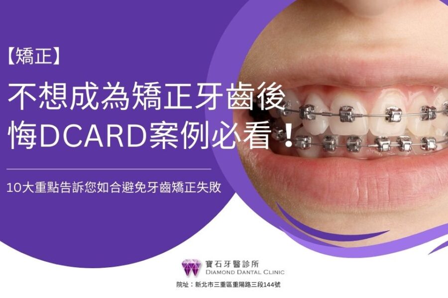 不想成為矯正牙齒後悔Dcard案例必看！10大重點告訴您如合避免牙齒矯正失敗